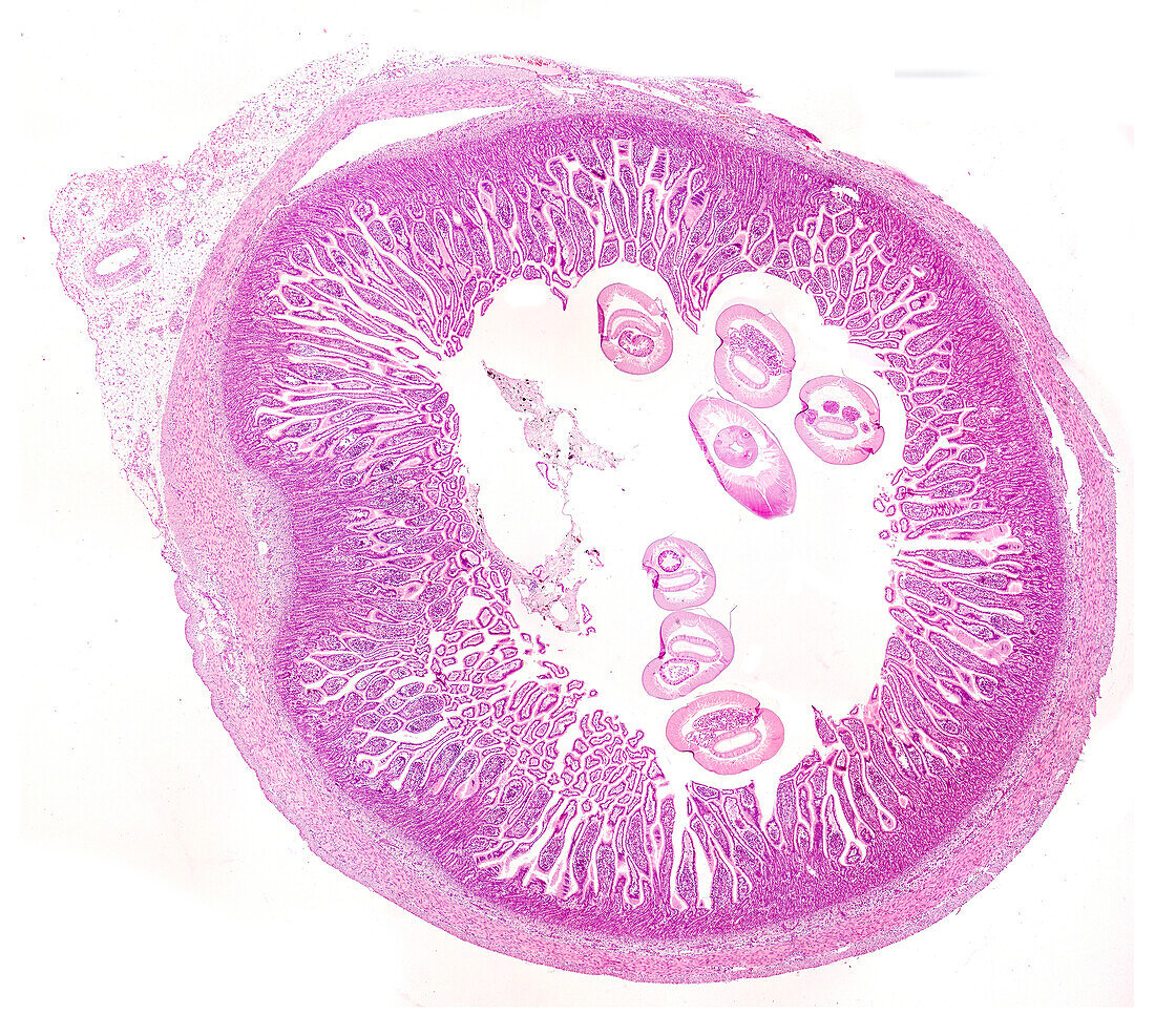 Parasites in dog small intestine, light micrograph