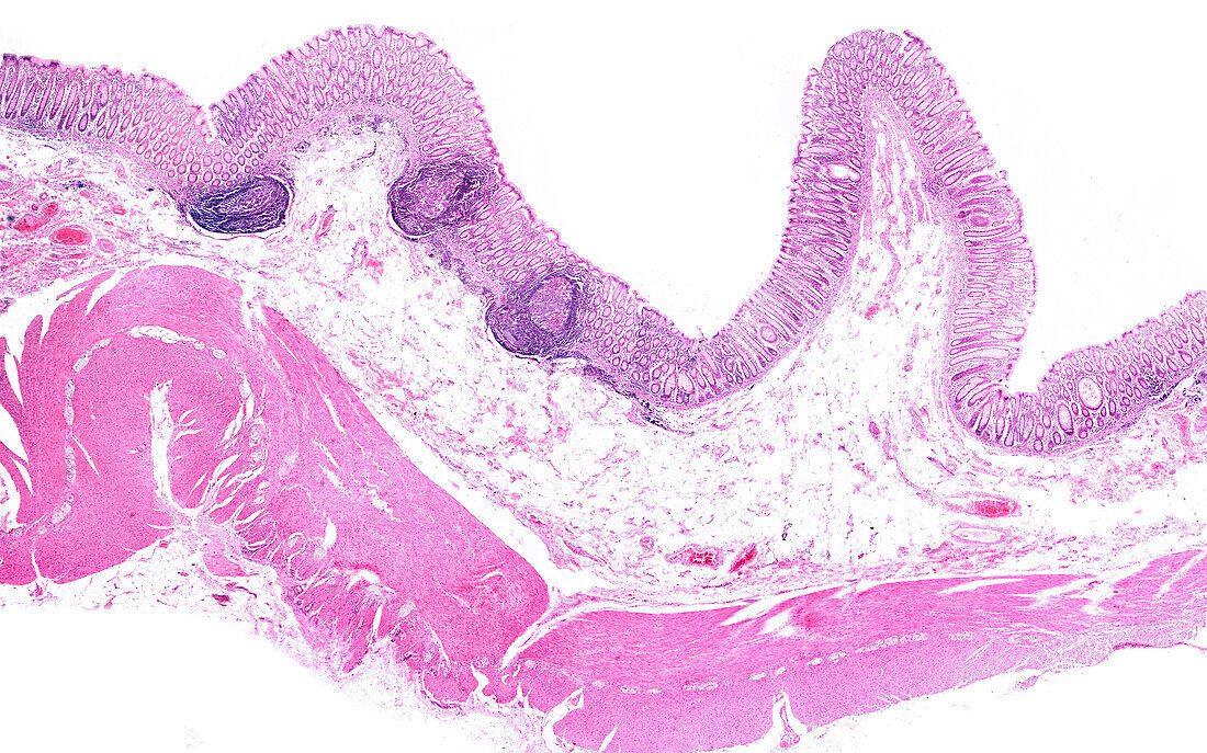 Human large intestine wall, light micrograph