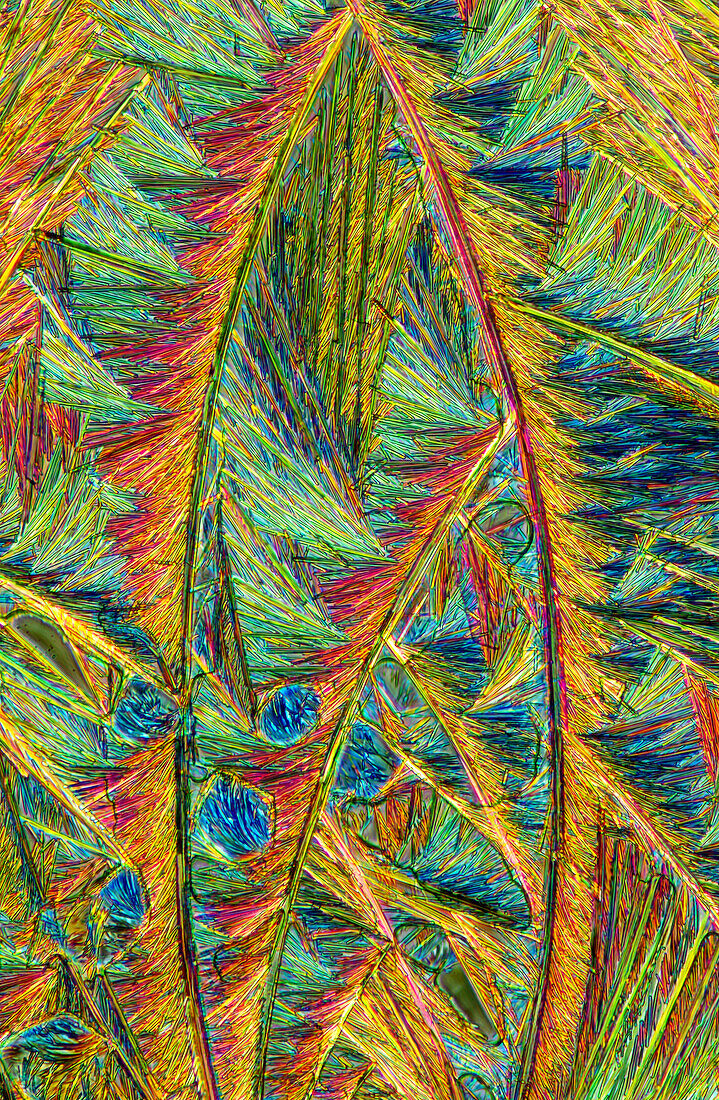 Callus remover crystals, light micrograph