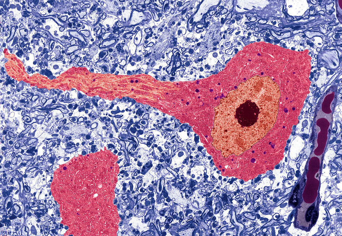 Nerve cell, TEM