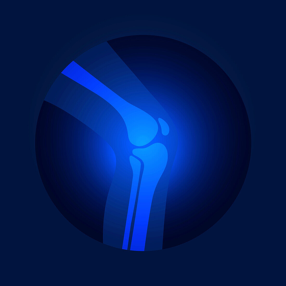 Knee pain, conceptual illustration
