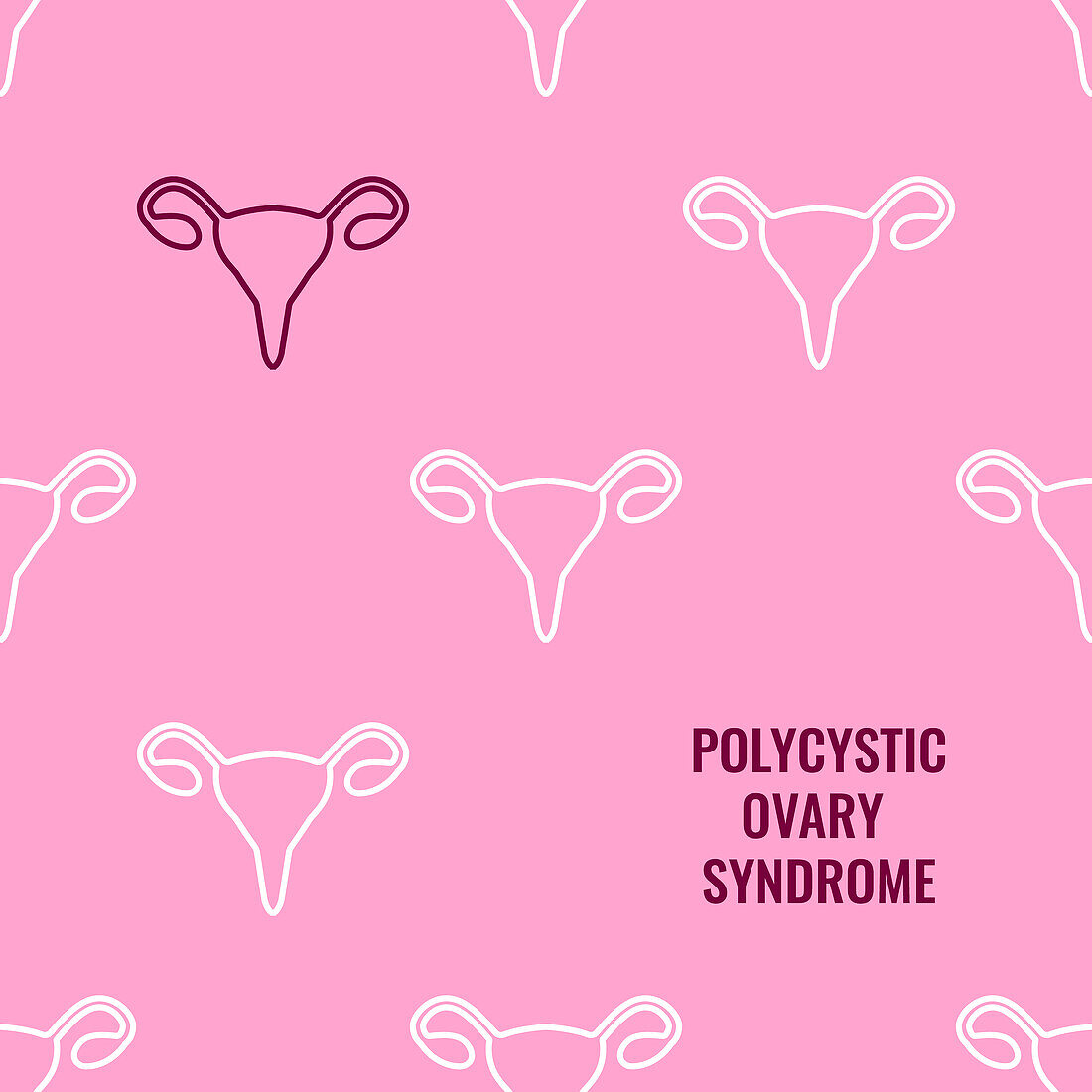 Polycystic ovary syndrome awareness, conceptual illustration