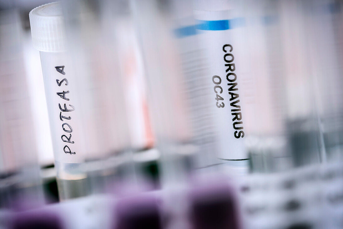 Coronavirus research
