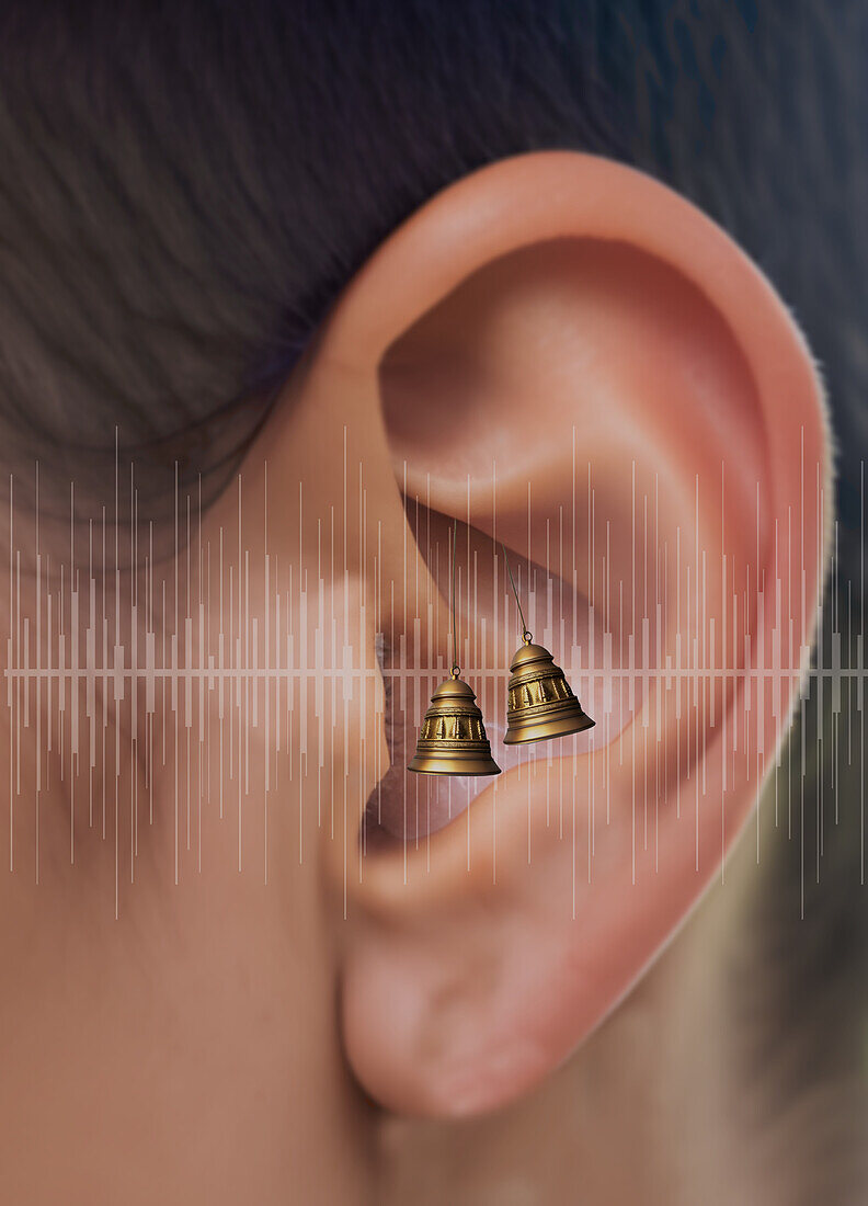 Tinnitus, conceptual illustration