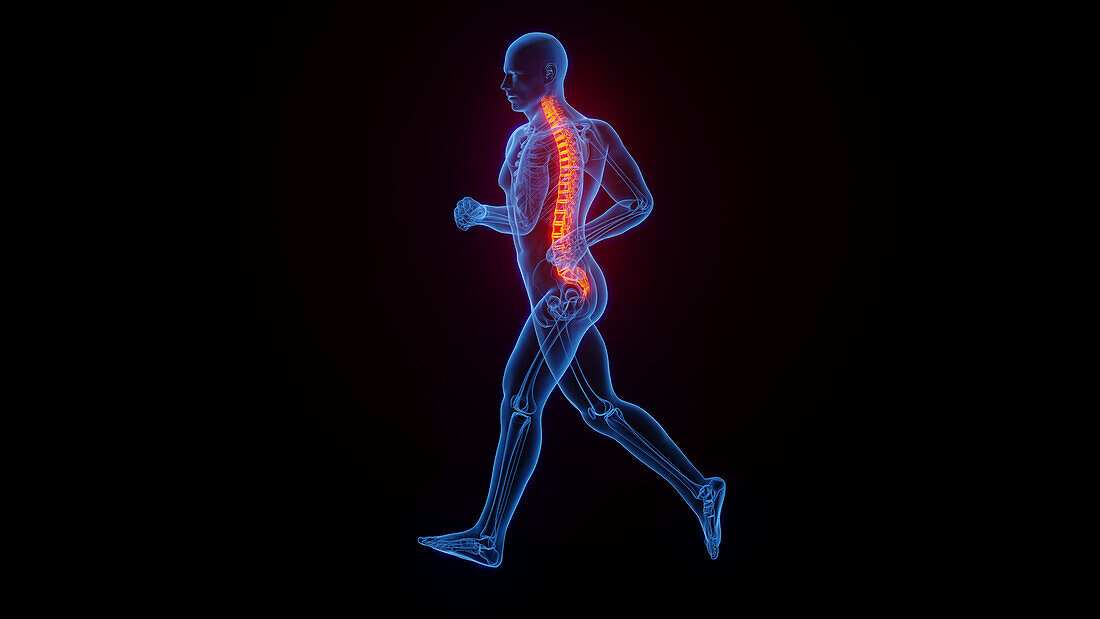 Back pain while jogging, illustration