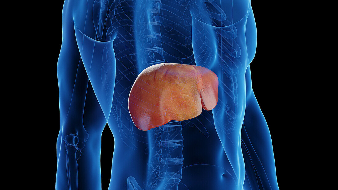 Healthy liver turning into fatty liver, illustration