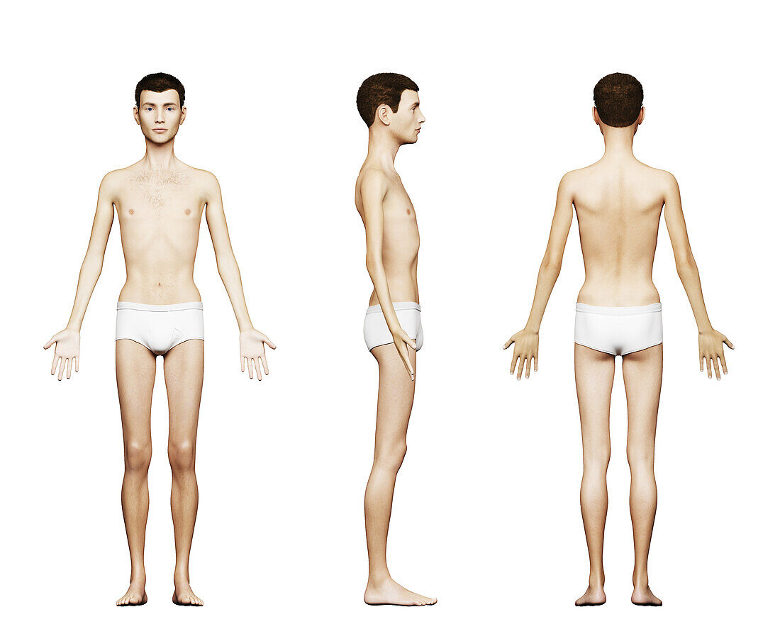 Underweight male body, illustration
