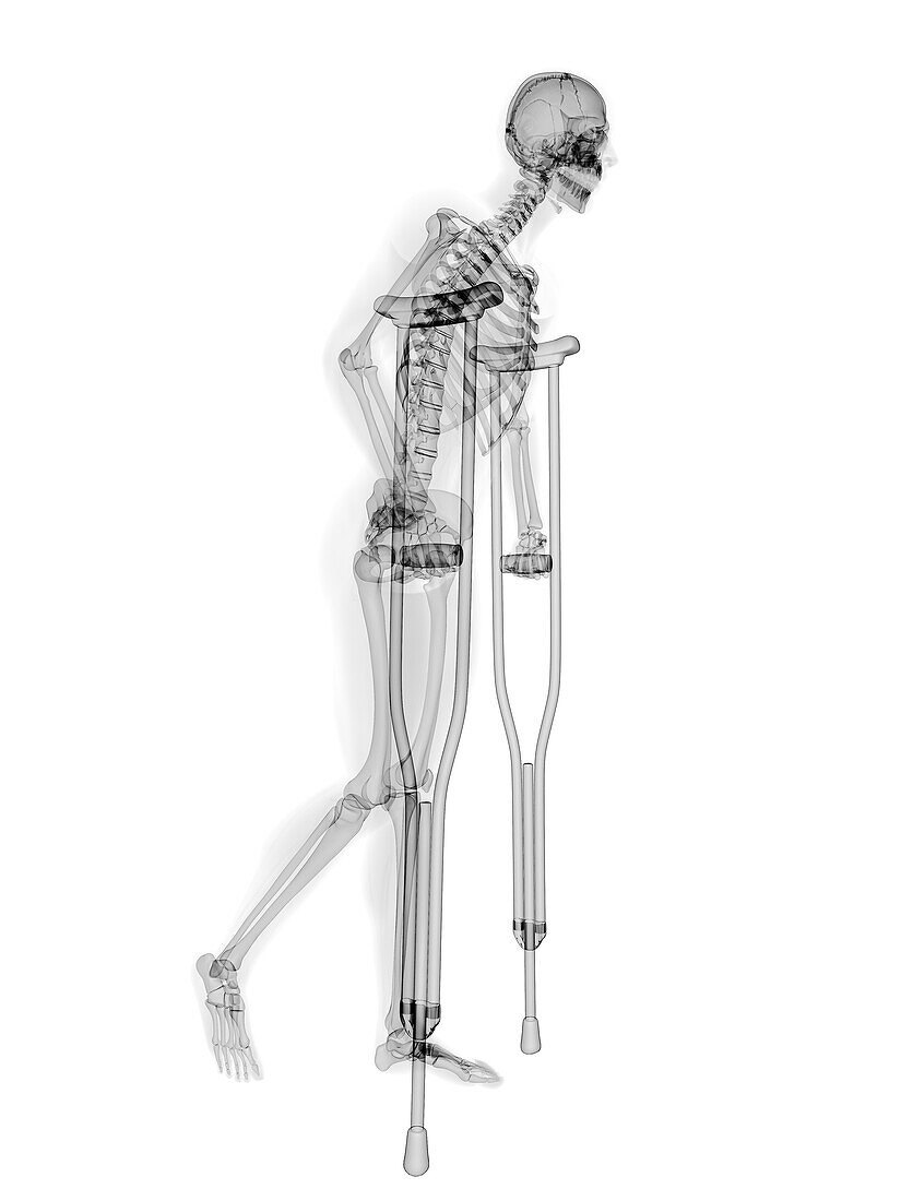 Man with crutches, illustration