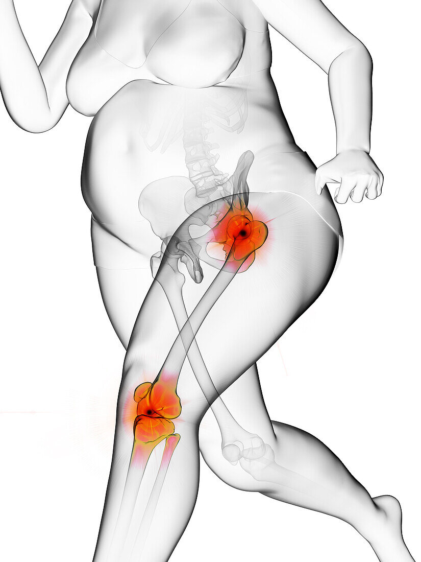 Overweight woman running with painful joints, illustration