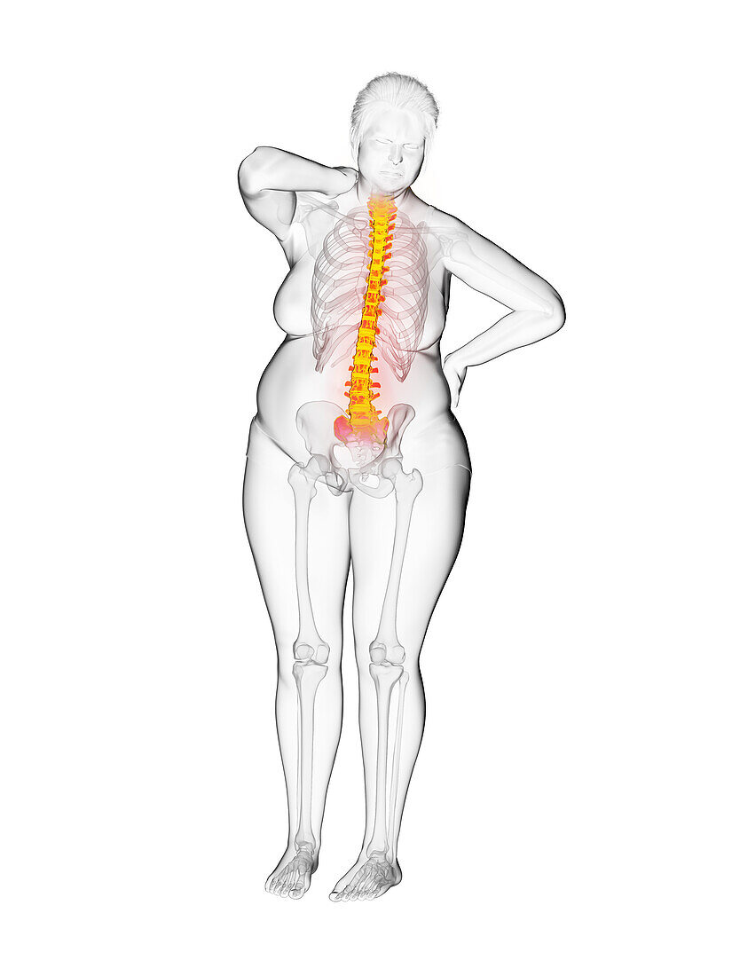 Overweight woman with painful back, illustration
