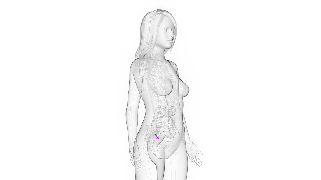 Female appendix, illustration