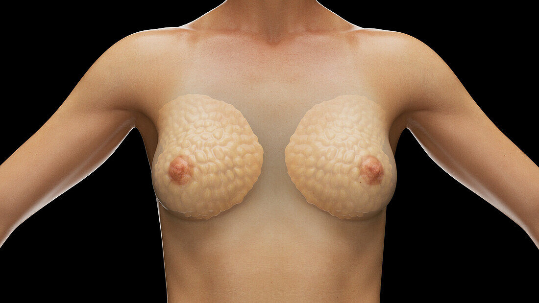 Breast, illustration