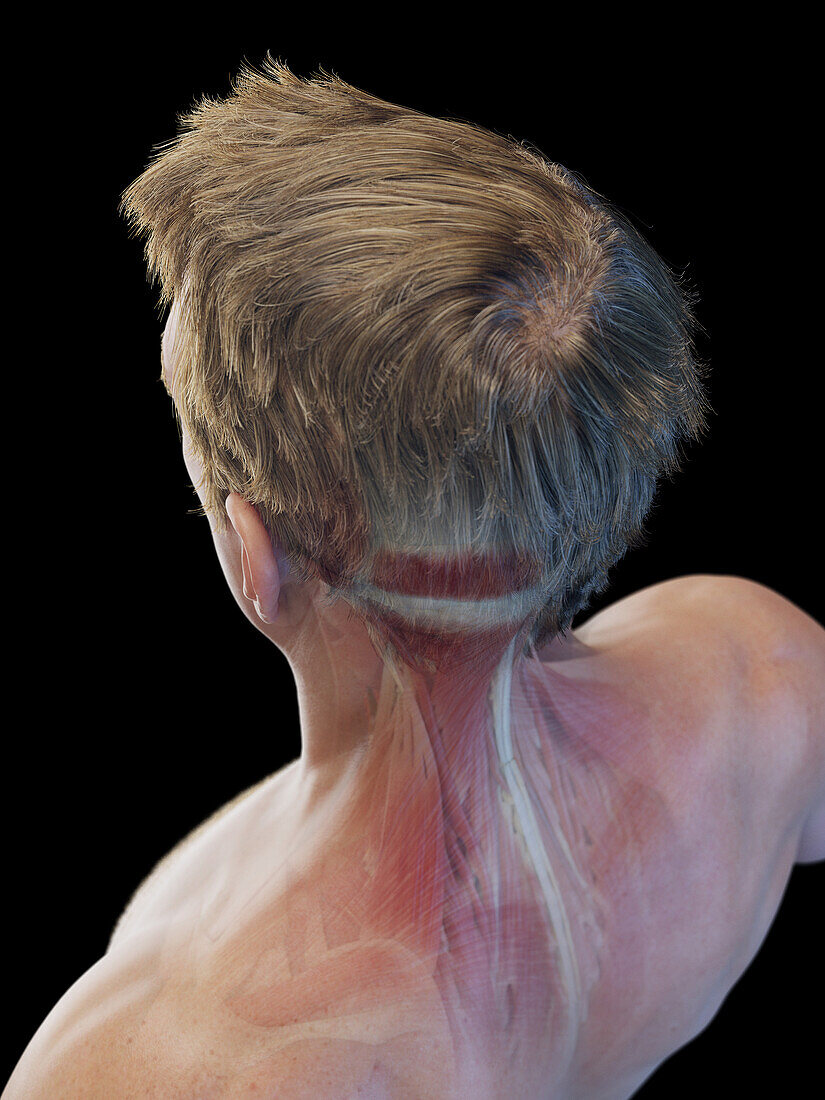 Male superficial neck muscles, illustration