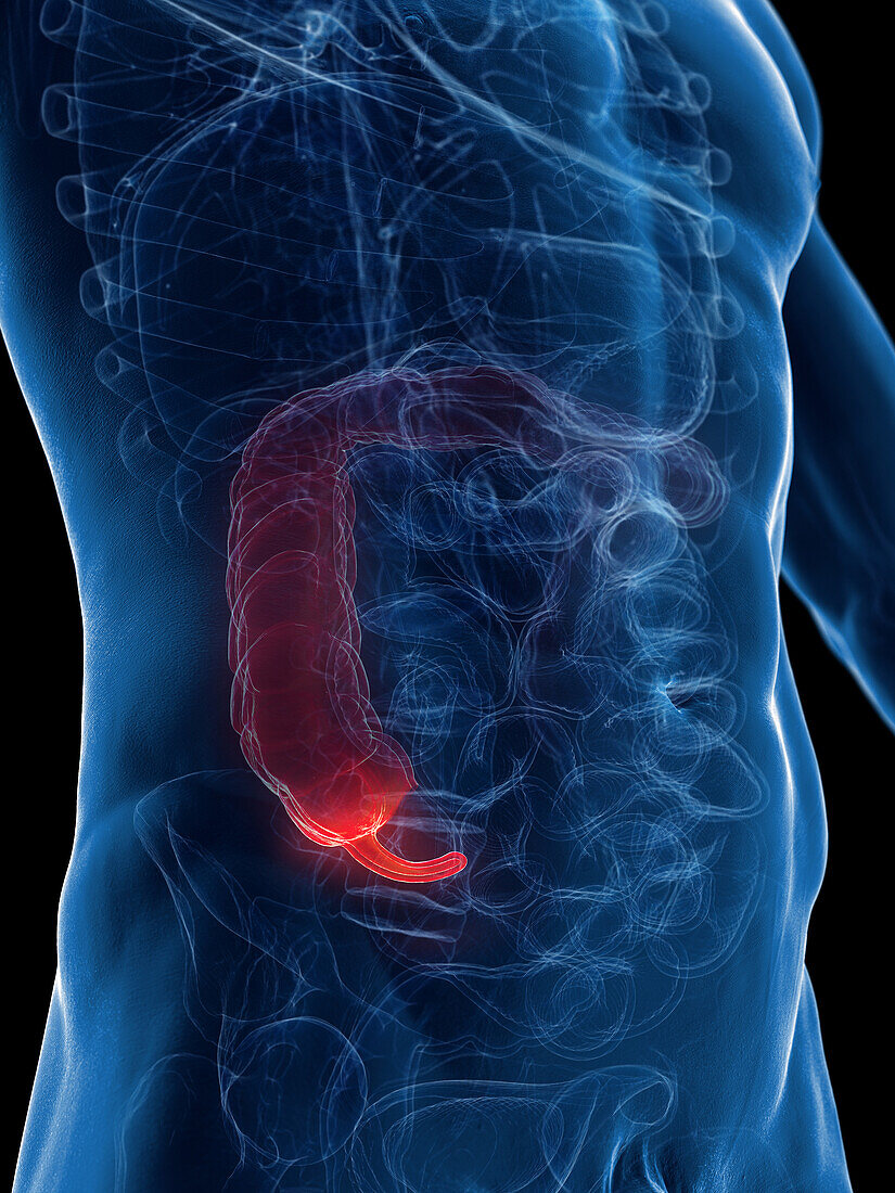 Male ascending colon and cecum, illustration