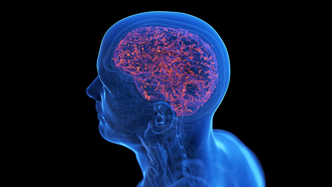 Infected human brain, illustration