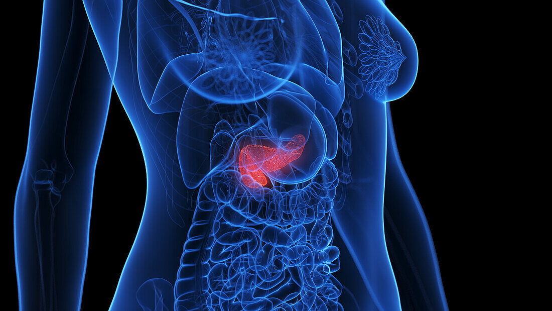Inflamed pancreas, illustration