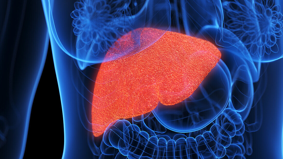 Inflamed liver, illustration