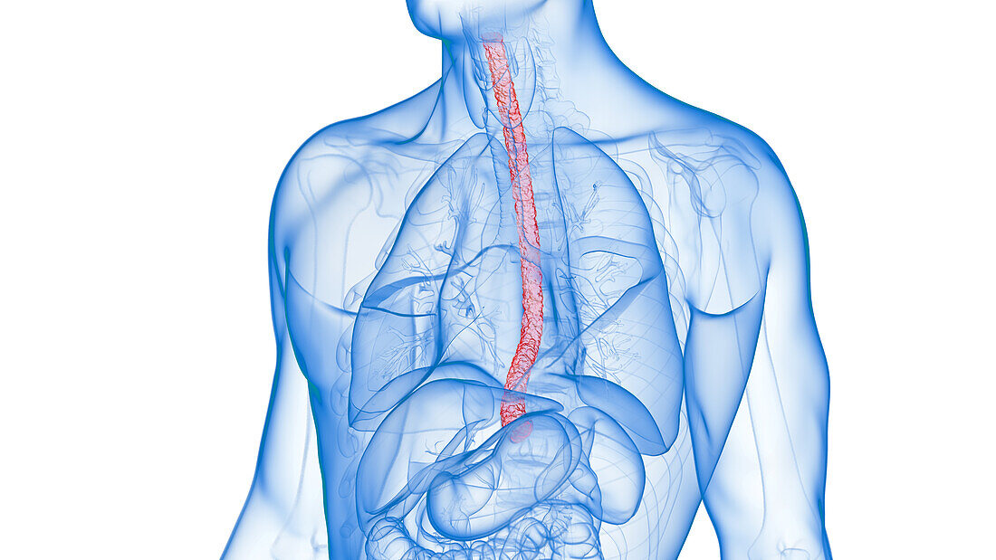 Inflamed oesophagus, illustration