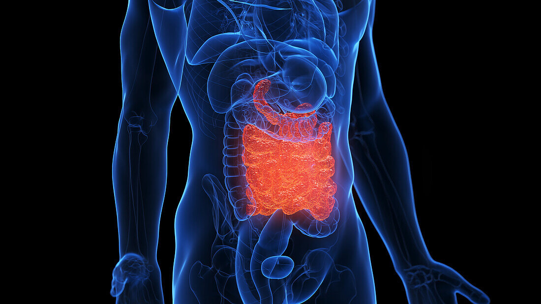 Inflamed small intestine, illustration