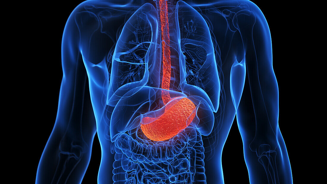 Inflamed stomach, illustration