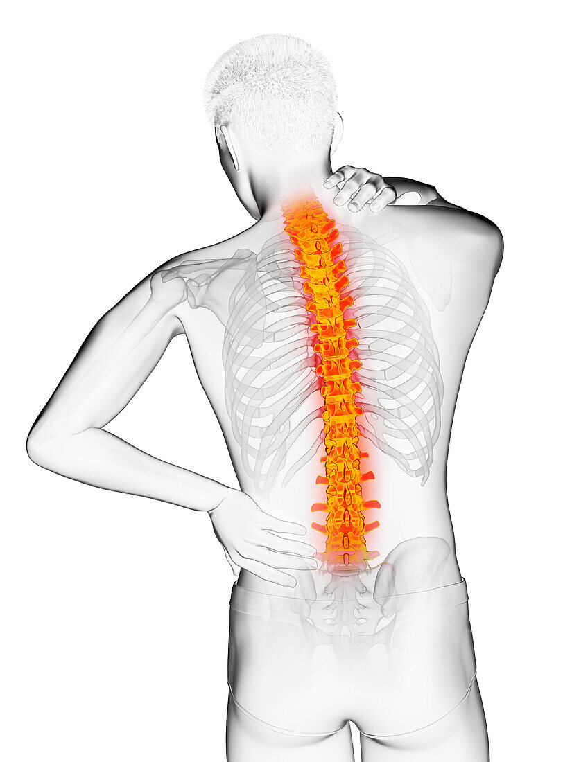 Man's painful back, illustration