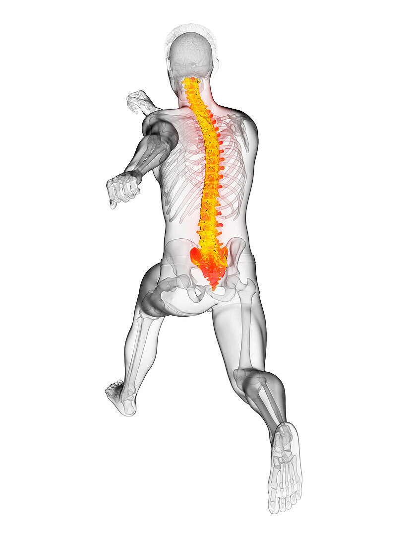 Runner's painful back, illustration