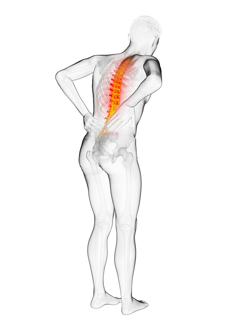 Man with acute back pain, illustration
