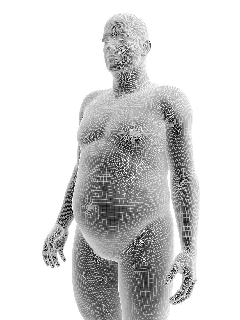 Obese male body, illustration