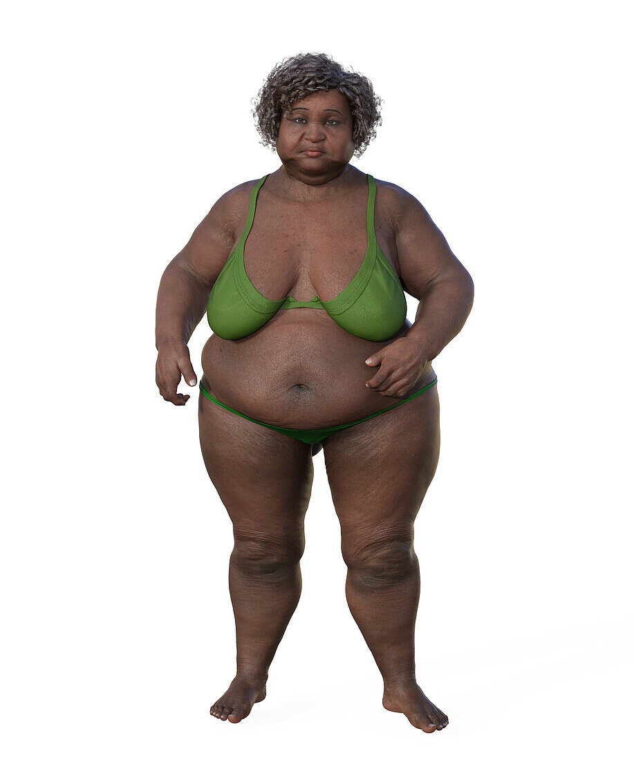 Overweight woman, illustration