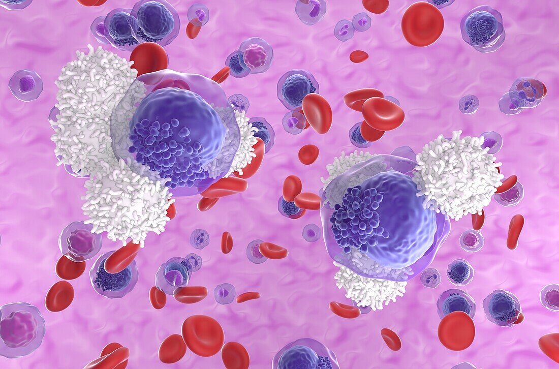 T cell attacking leukemia cell, illustration