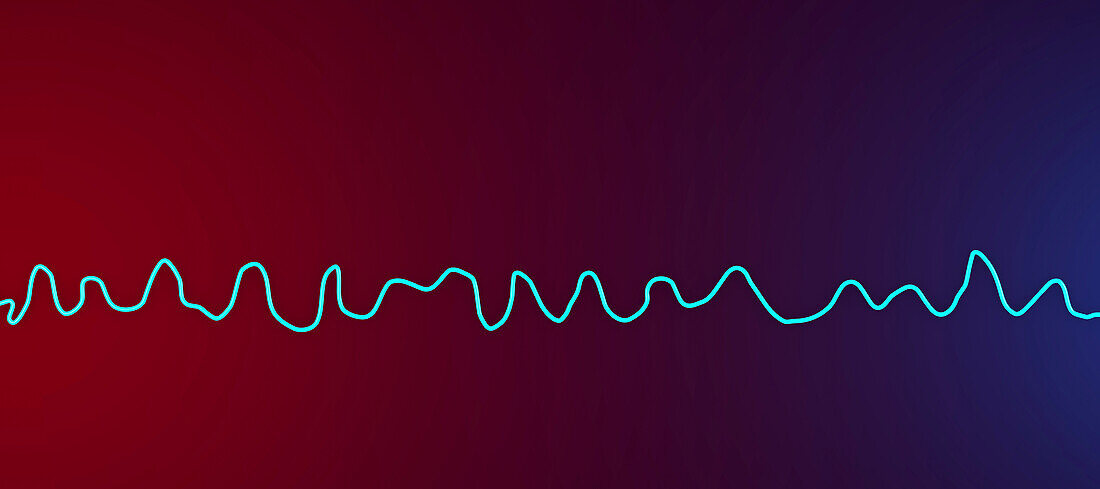 Ventricular fibrillation heartbeat rhythm, illustration