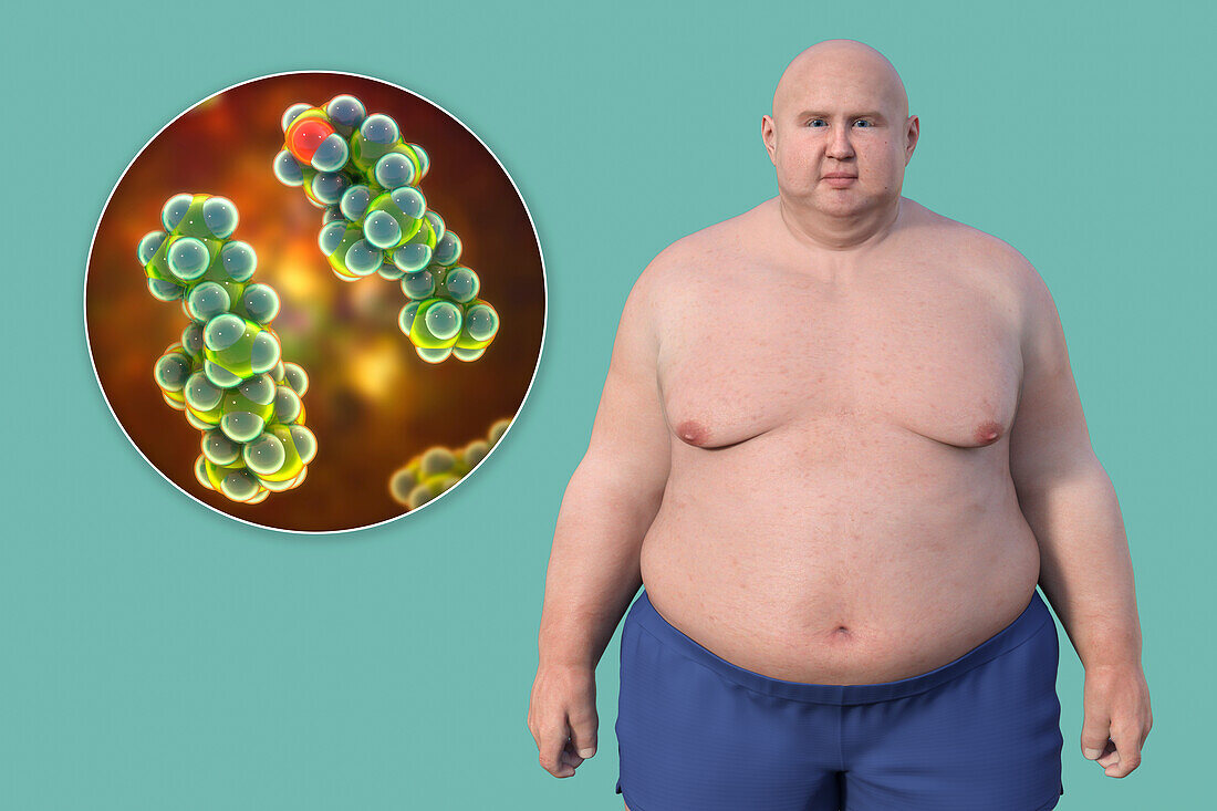 Overweight man and cholesterol molecule, illustration