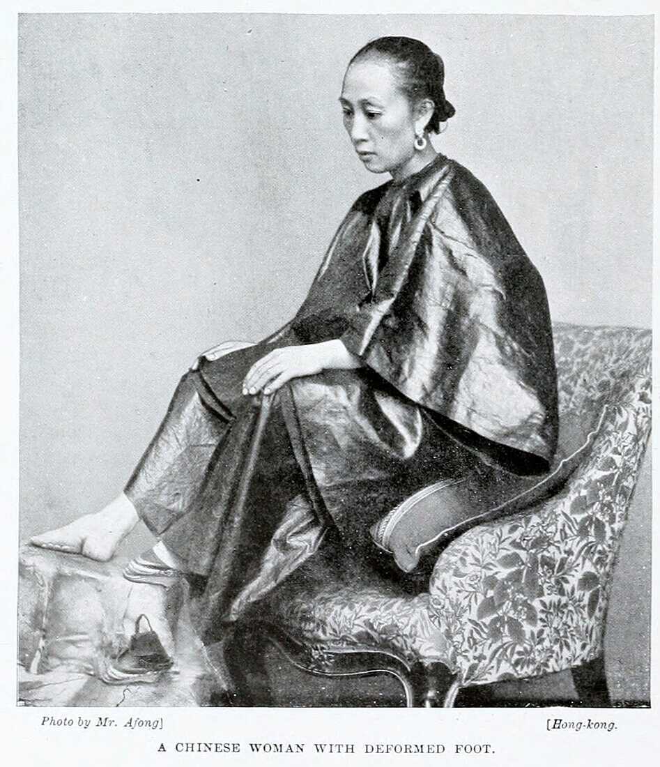 Chinese woman with bound foot