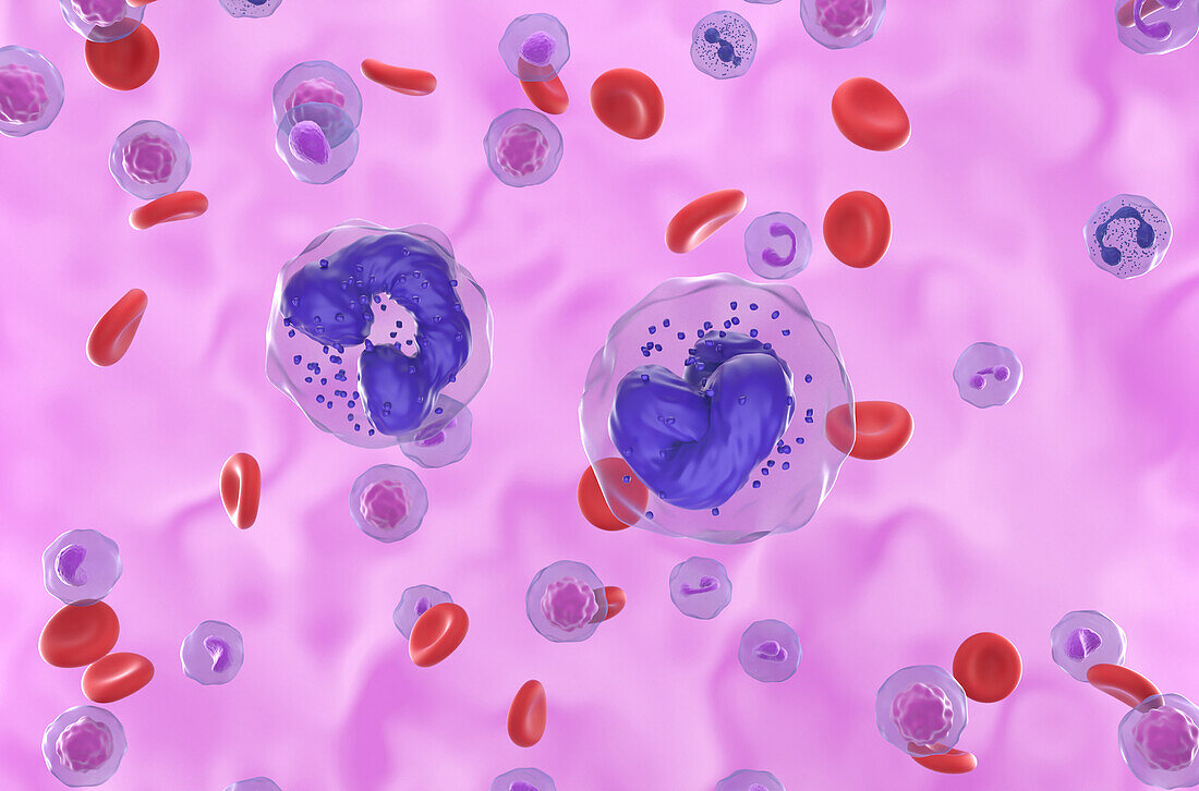 Chronic myeloid leukaemia, illustration