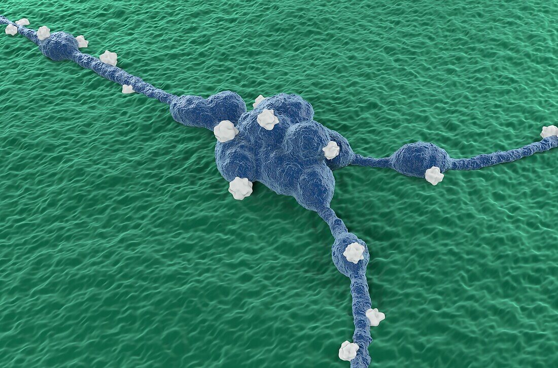 Neuroblastoma cancer cells, illustration