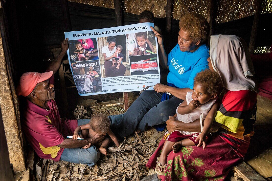 Papua New Guinea, Southern Highlands Province, Mendi, a young girl, Adaline, who as malnorished has now recover after one year. The supplies and training for monitoring of the nutritional status children was provided by UNICEF