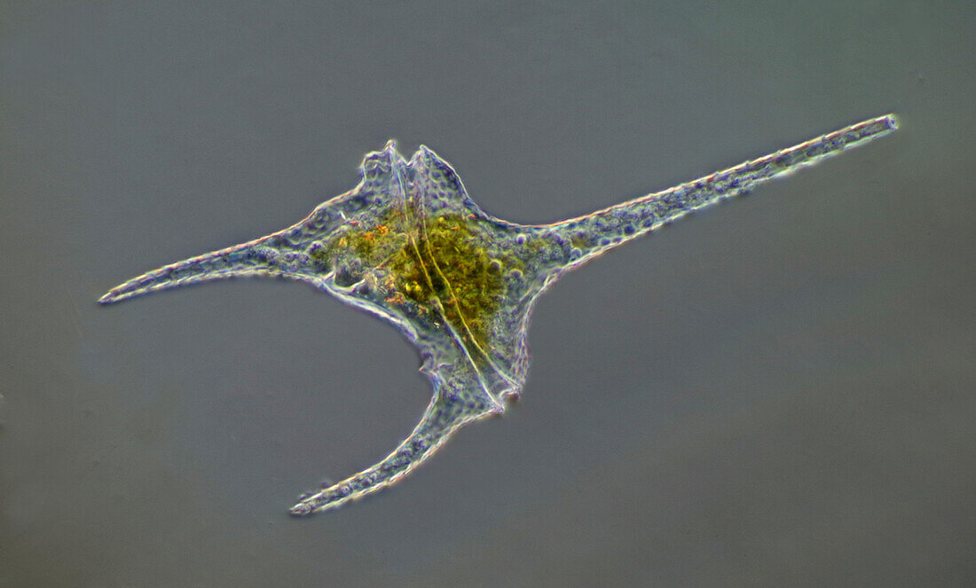 Ceratium hirundinella, light micrograph