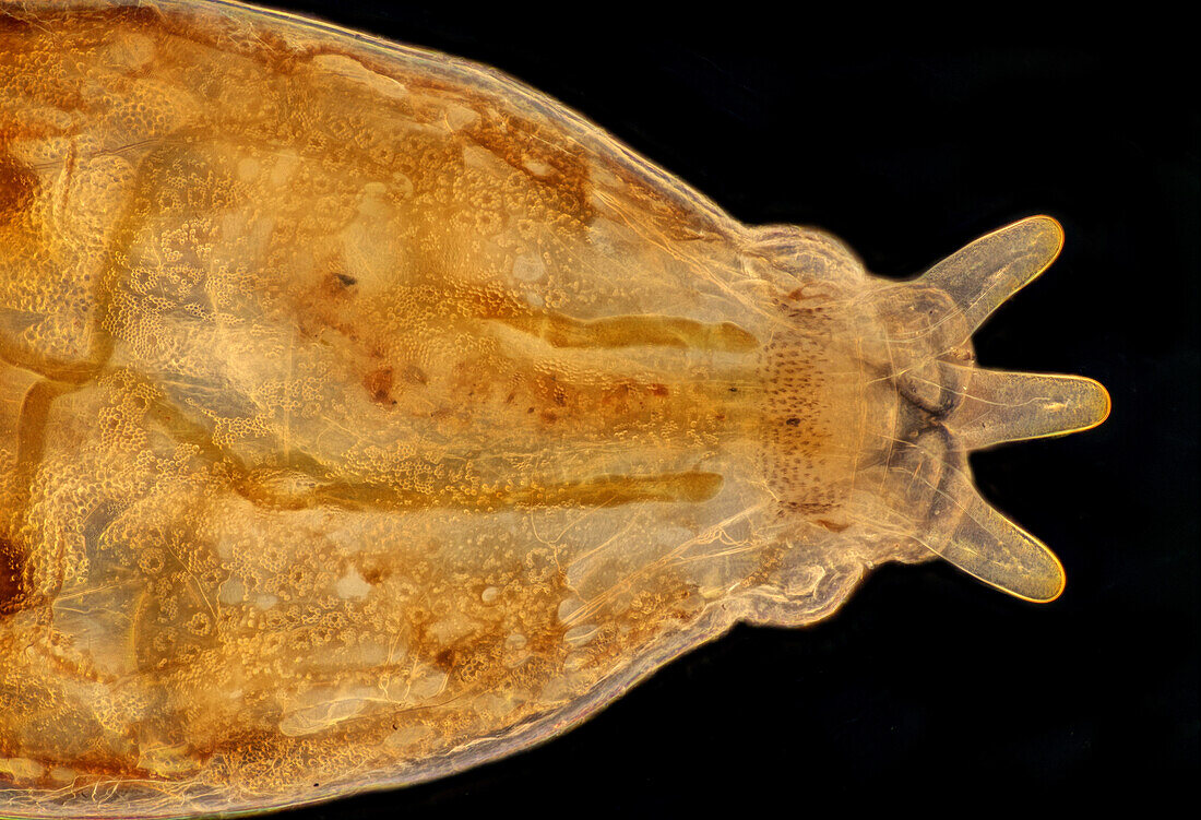 Blackfly larva, light micrograph