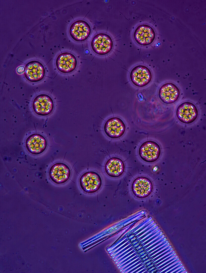 Pandorina sp. green algae and diatom, light micrograph