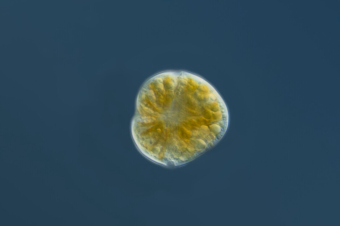 Alexandrium tamutum algae, light micrograph