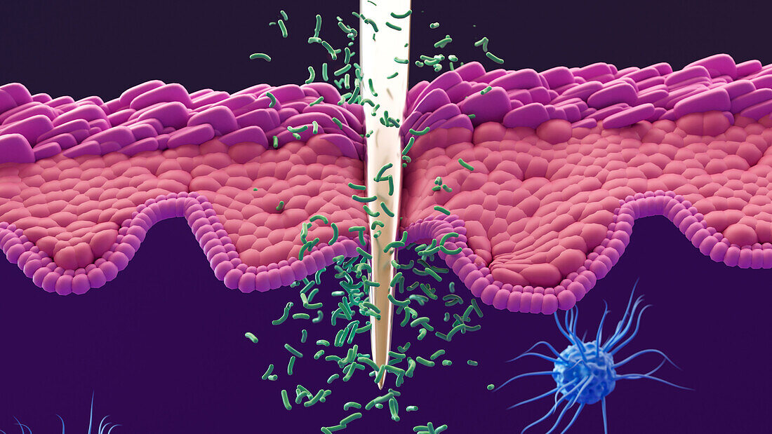 Bacteria entering the body via a needle wound, illustration