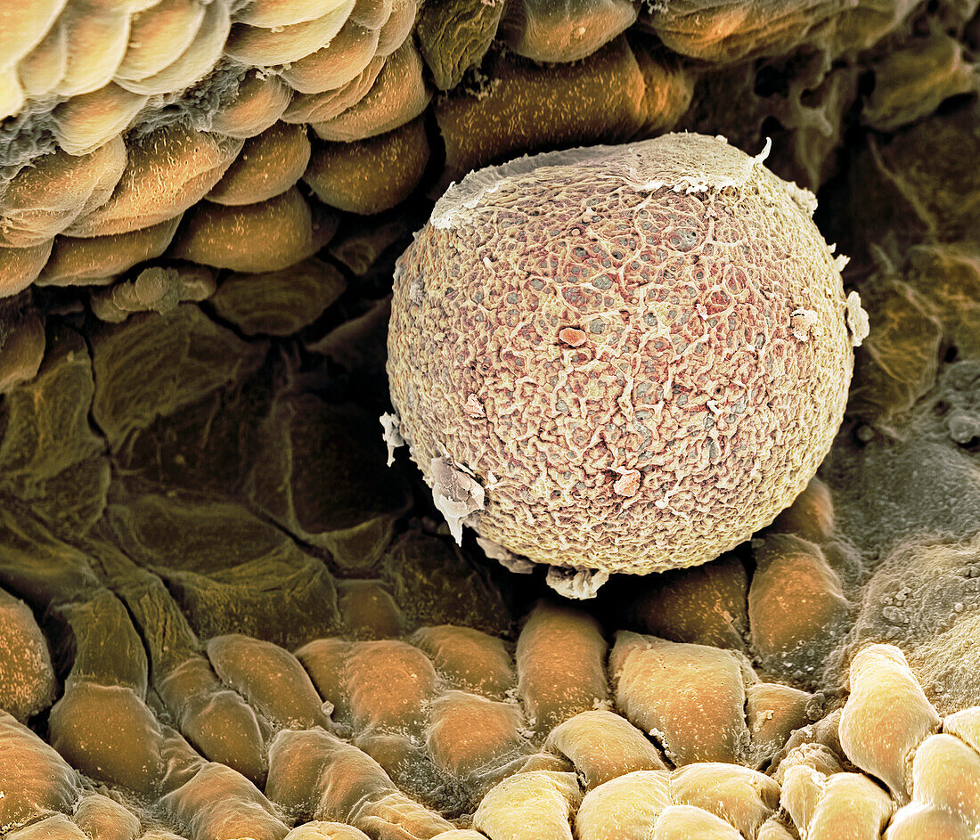 Human ovum in fallopian tube, SEM