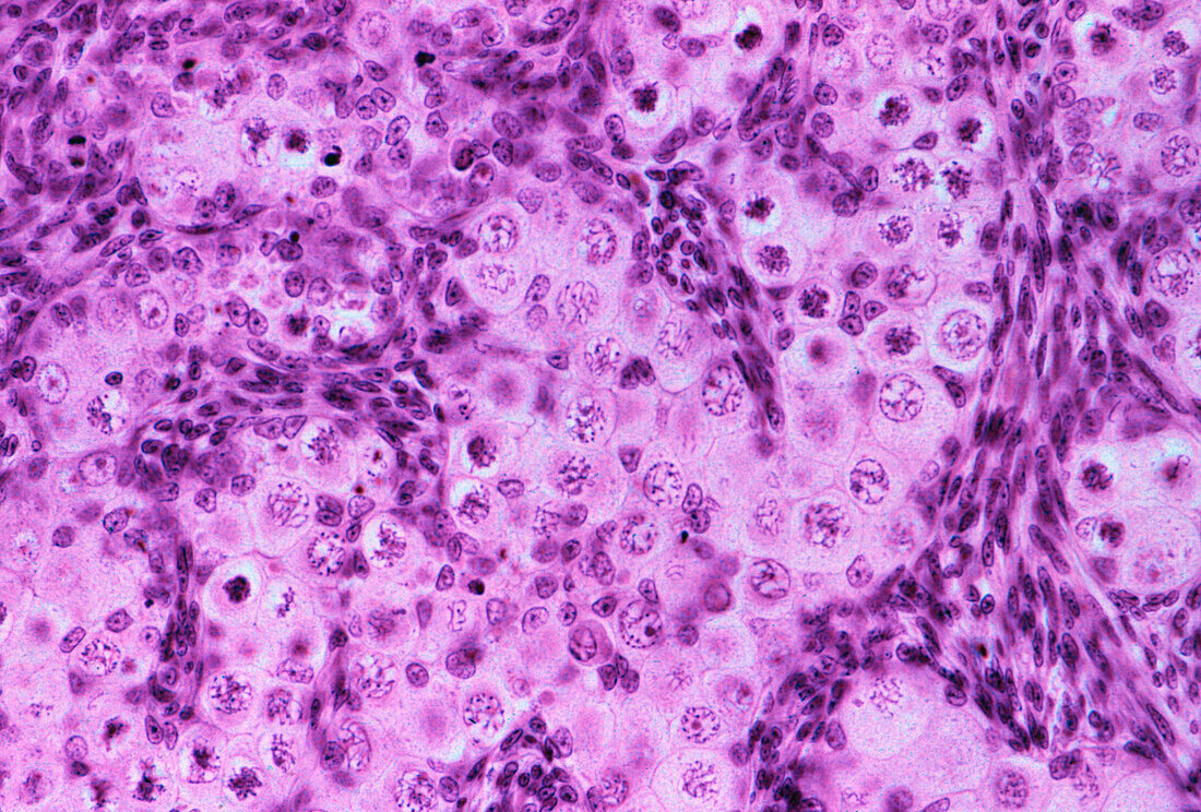 Foetal ovary meiosis, light micrograph