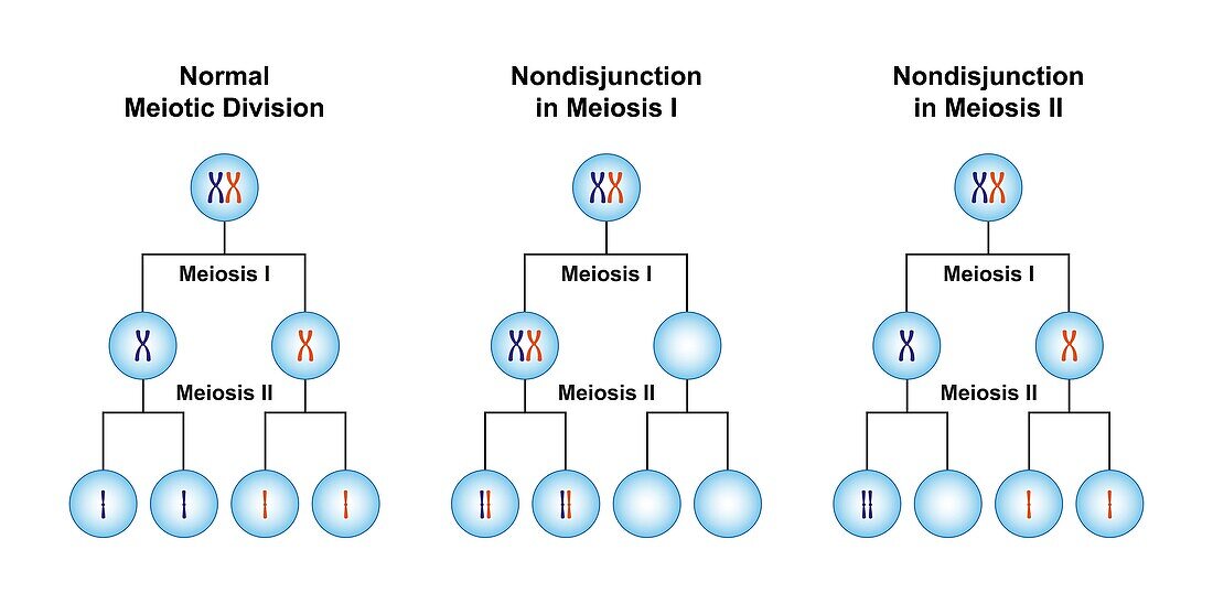 Nondisjunction in meiosis, illustration