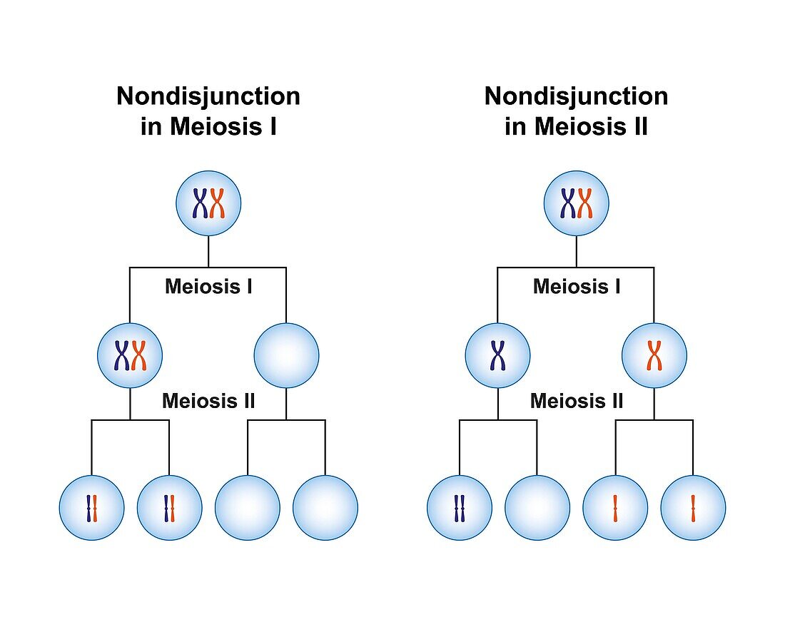 Nondisjunction in meiosis, illustration