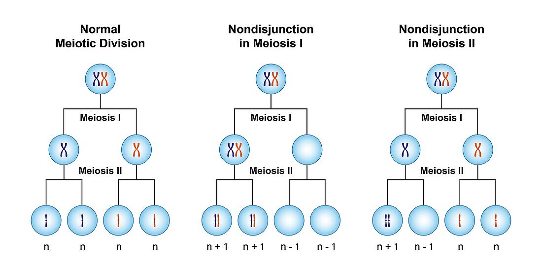 Nondisjunction in meiosis, illustration