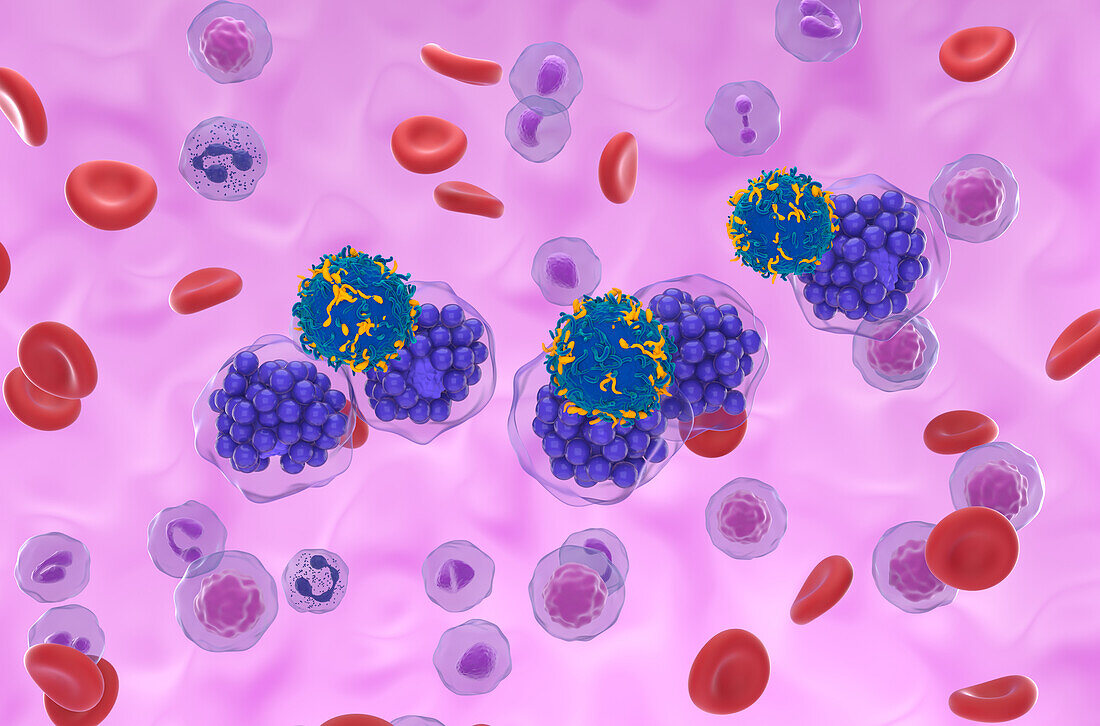 CAR-T cell therapy for diffuse large B-cell lymphoma, illustration