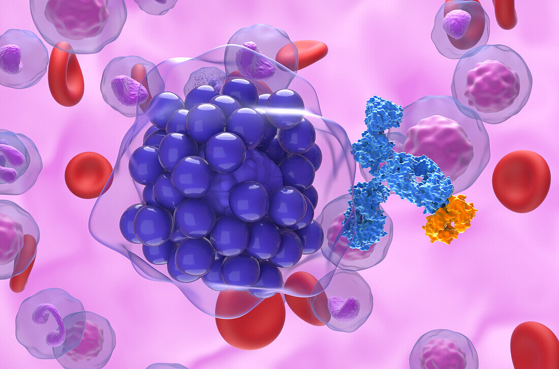 Monoclonal antibody therapy for diffuse large B-cell lymphoma, illustration