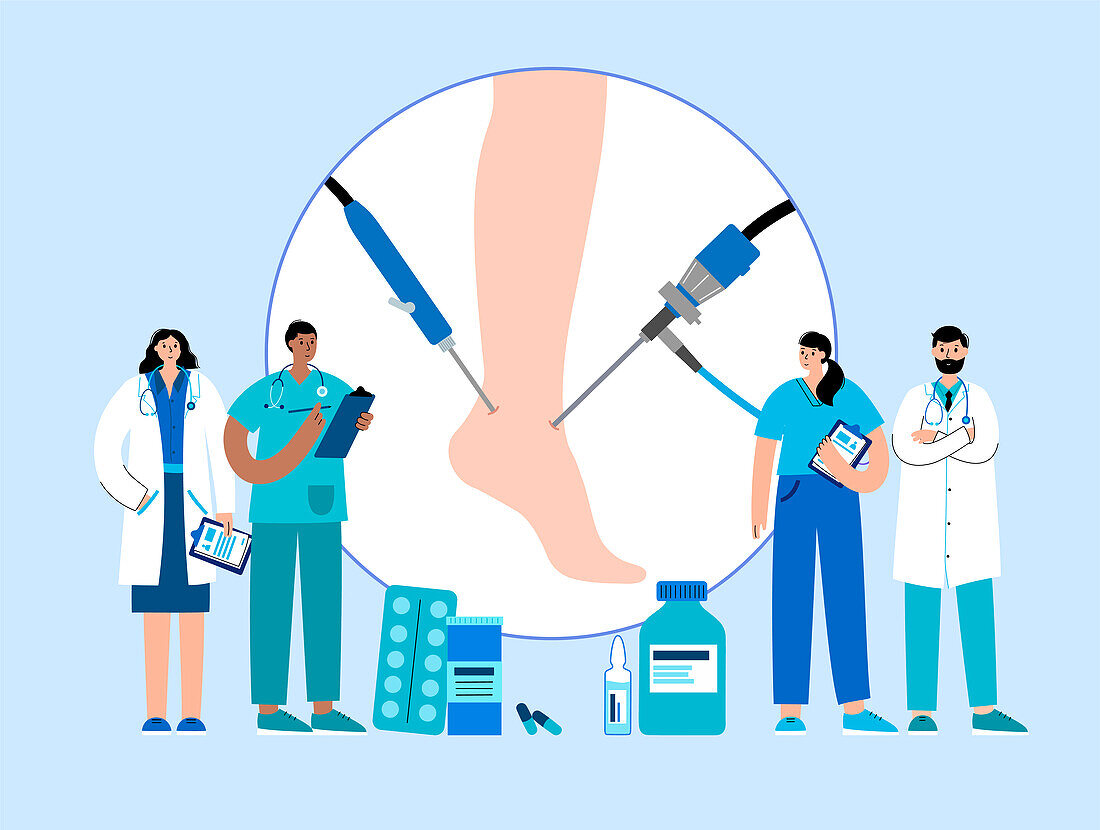 Ankle arthroscopy procedure, illustration