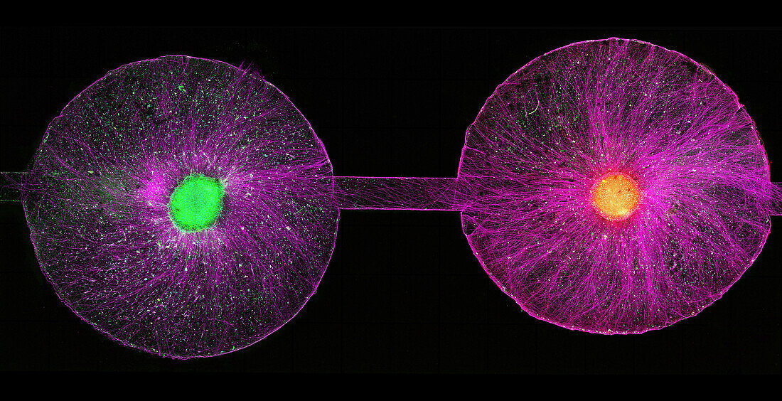 Brain organoids, light micrograph